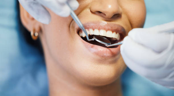 Best Emergency Dental Care for Broken or Chipped Teeth in Avalon, CA