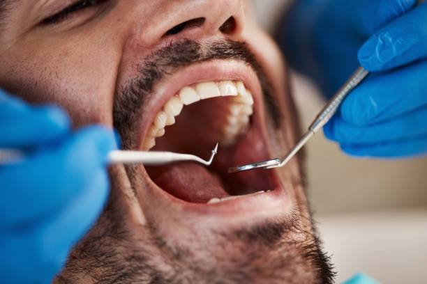 Best Cosmetic Emergency Dentistry in Avalon, CA