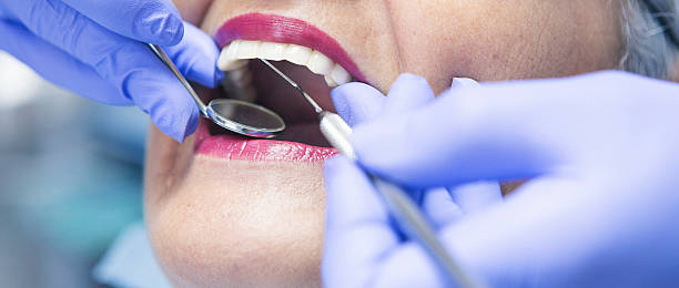 Best Emergency Dental Care for Broken or Chipped Teeth in Avalon, CA